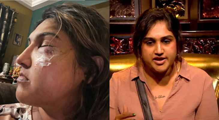 Late night attack on Bigg Boss fame Vanita